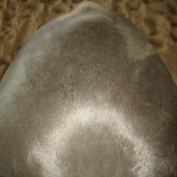 back hair pattern